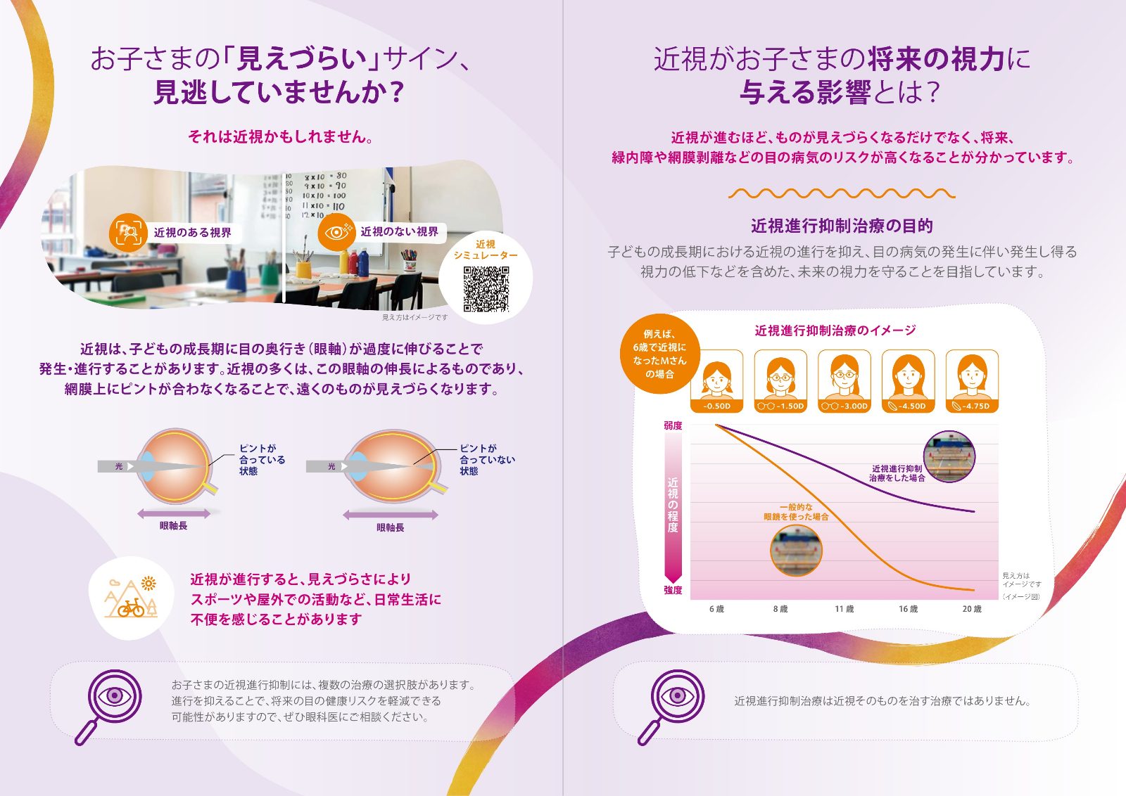 小児近視とマイサイト ワンデーの説明資料