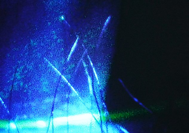 角膜表面に糸状の付着物がみられる参考画像