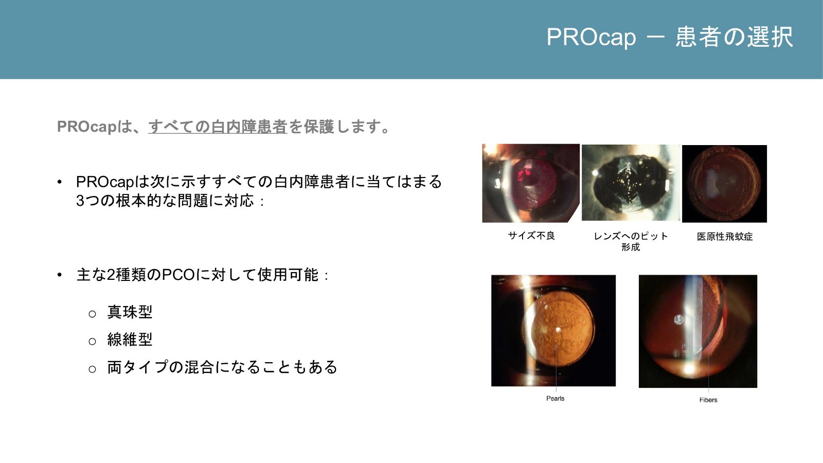 真珠型と線維型の後発白内障などを示すメーカー資料