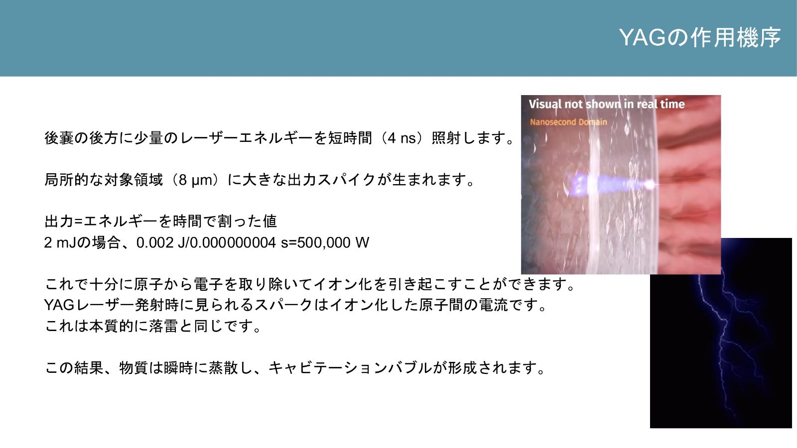 短時間のYAGレーザー照射でキャビテーションバブルが形成される仕組み