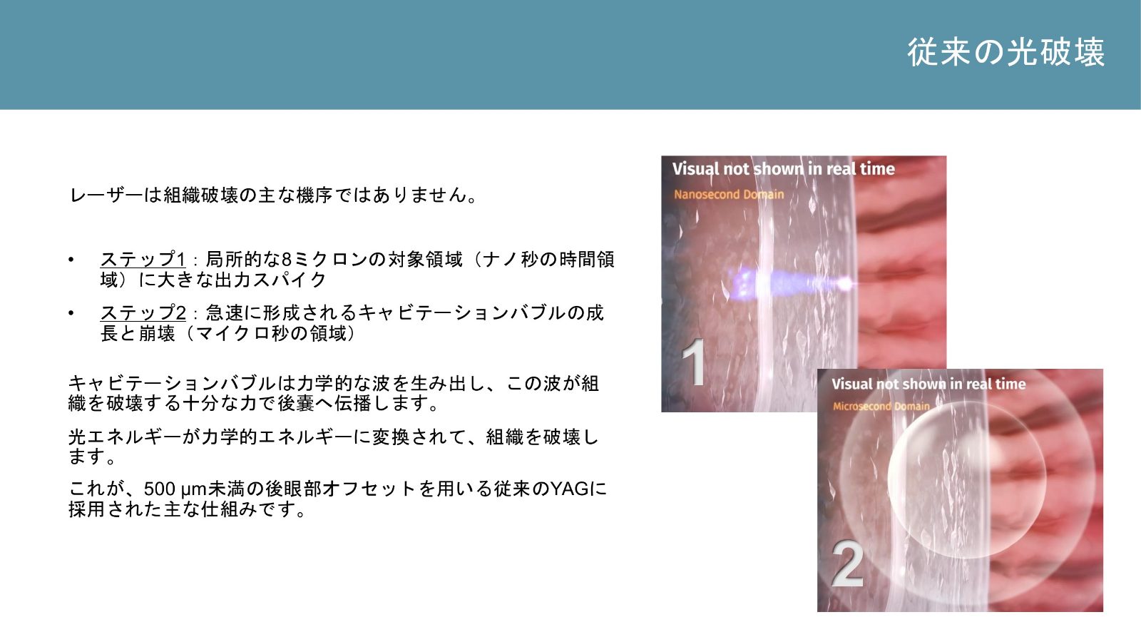 レーザー照射とキャビテーションバブルの成長および崩壊を示す資料