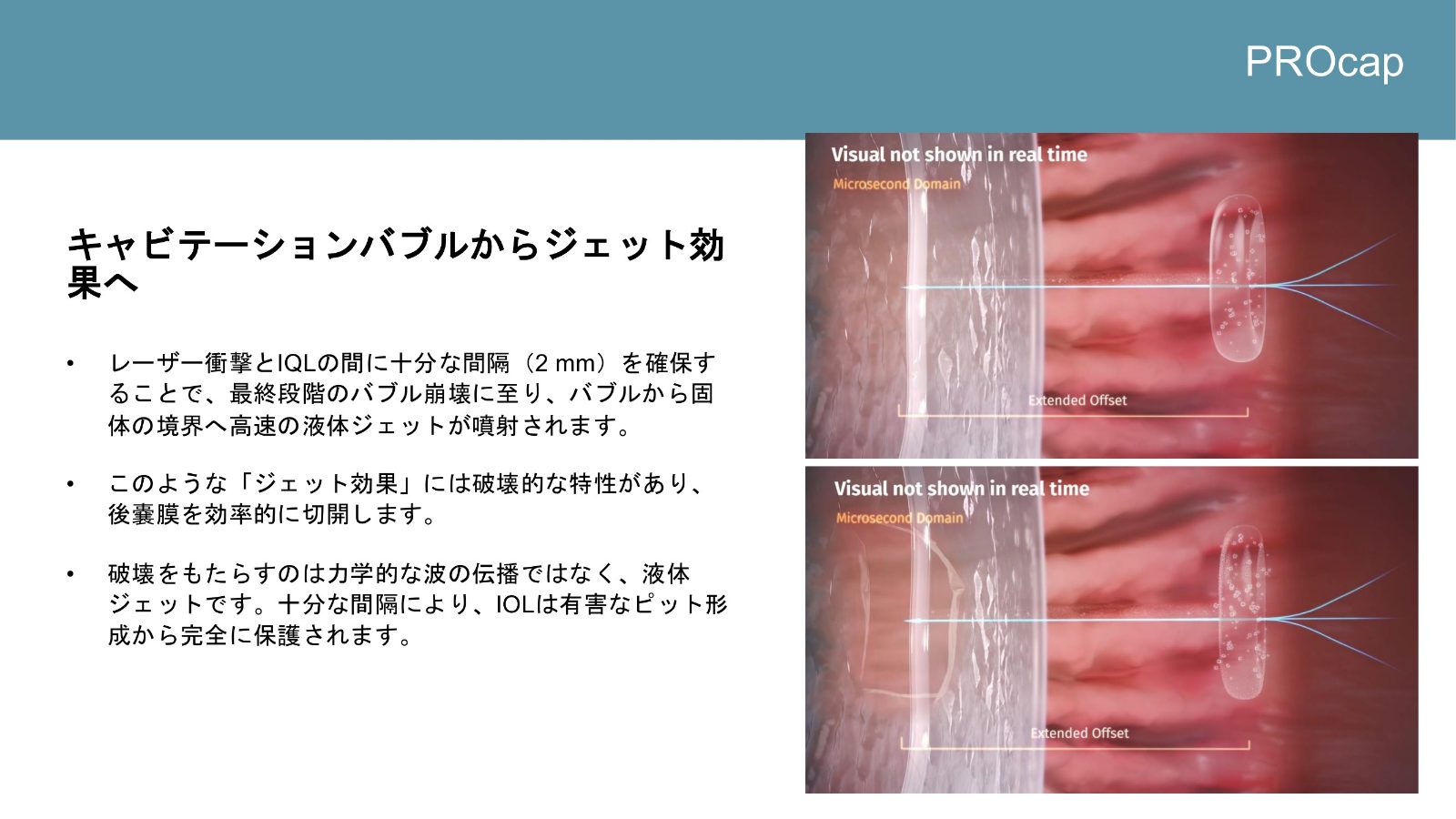 キャビテーションバブルの崩壊から液体ジェットが生じる模式図