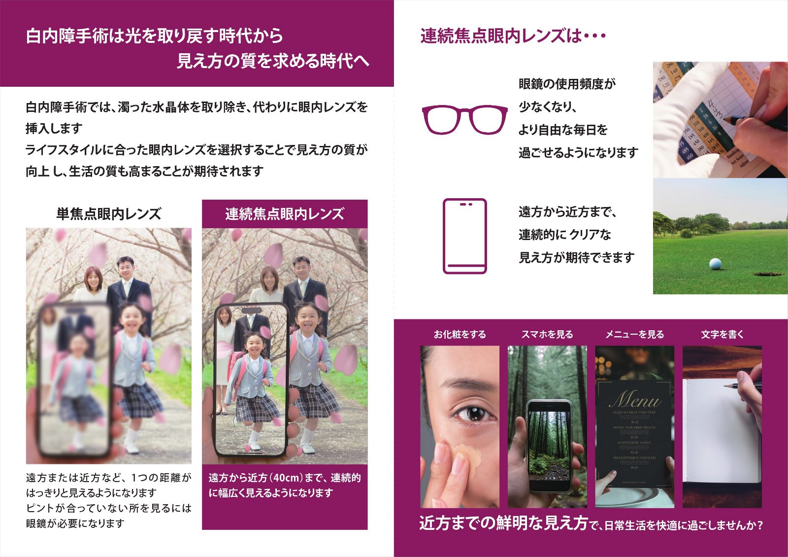 単焦点眼内レンズと連続焦点眼内レンズの見える距離を比較した説明