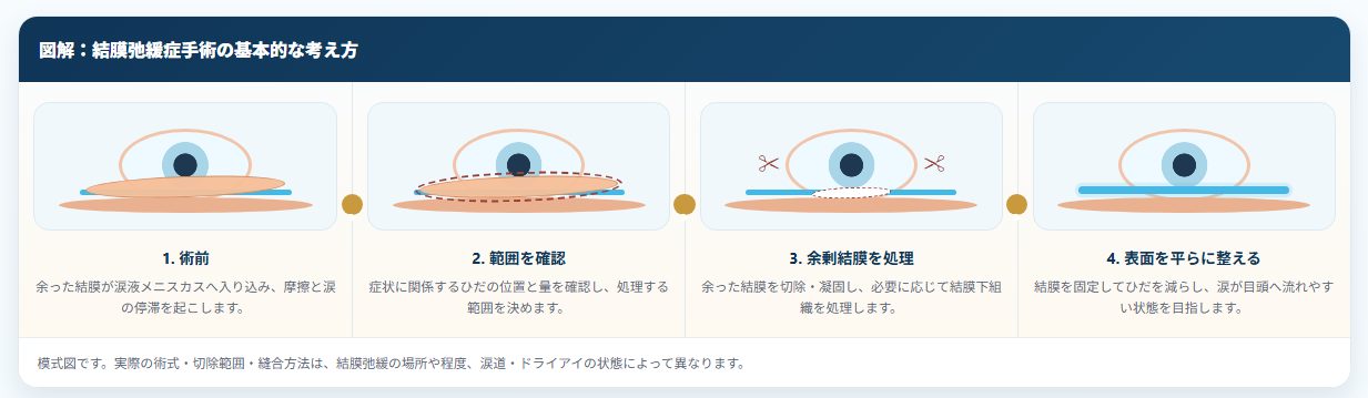 結膜弛緩症手術の流れを説明した画像