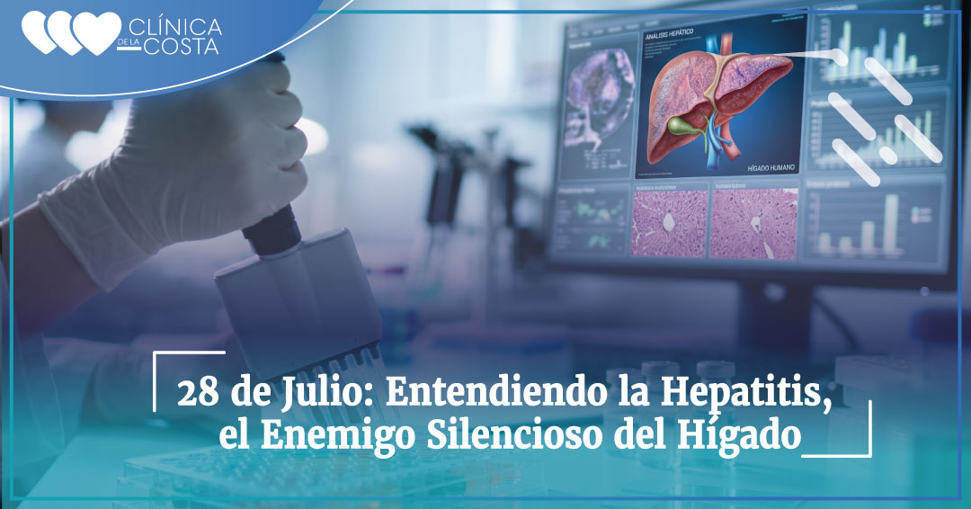 28 de Julio: Entendiendo la Hepatitis, el Enemigo Silencioso del Hígado