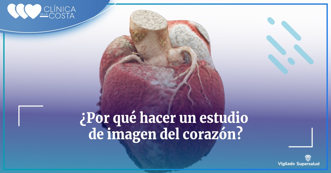 Enfermedad Cardiovascular: Un Asesino Silencioso y Prevenible
