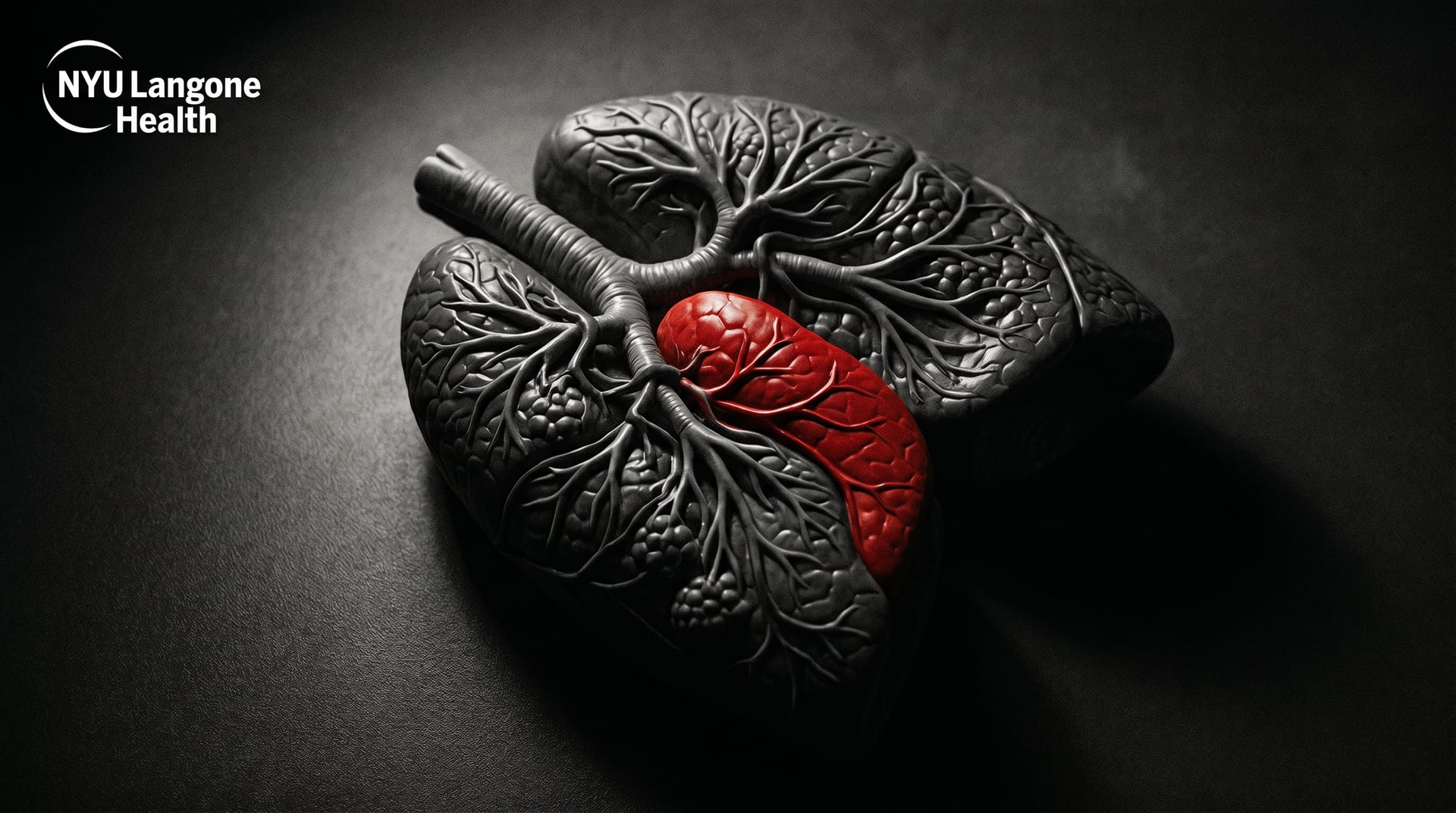 NYU Langone Health Performs World's First HIV-to-HIV Lung Transplant