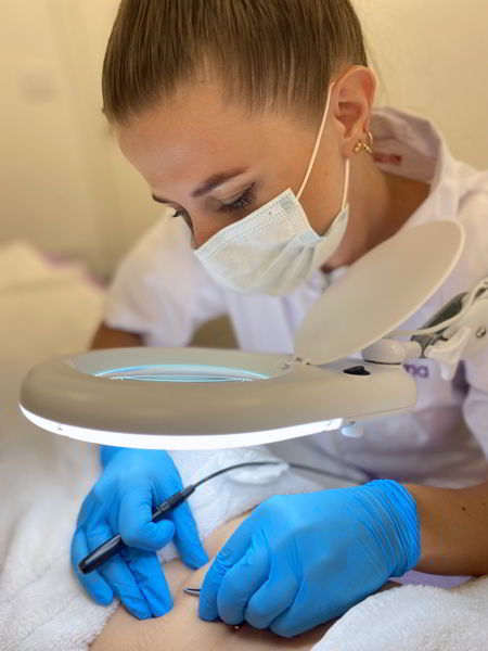علاج إزالة الشعر بالكهرباء