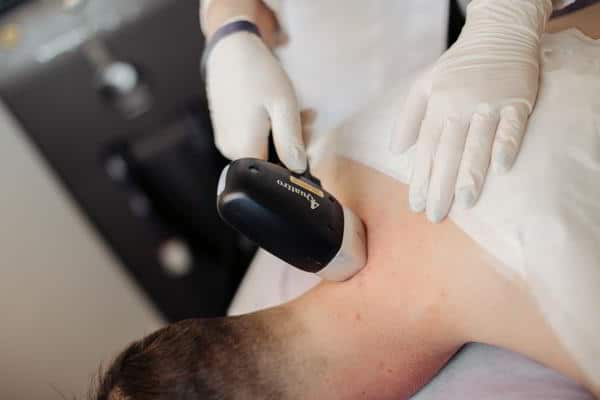 خرافات حول إزالة الشعر بالليزر