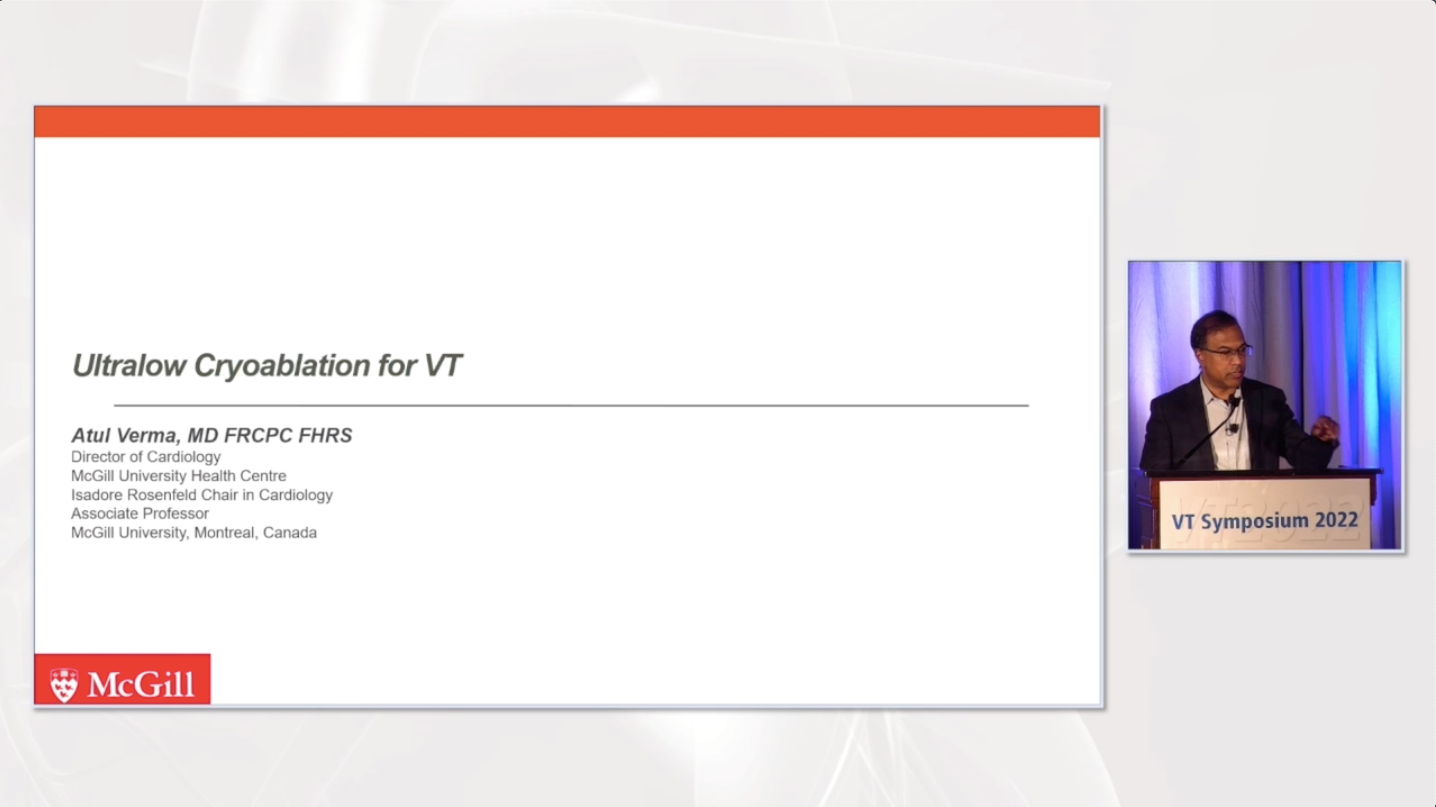 Ultralow Cryoablation for VT