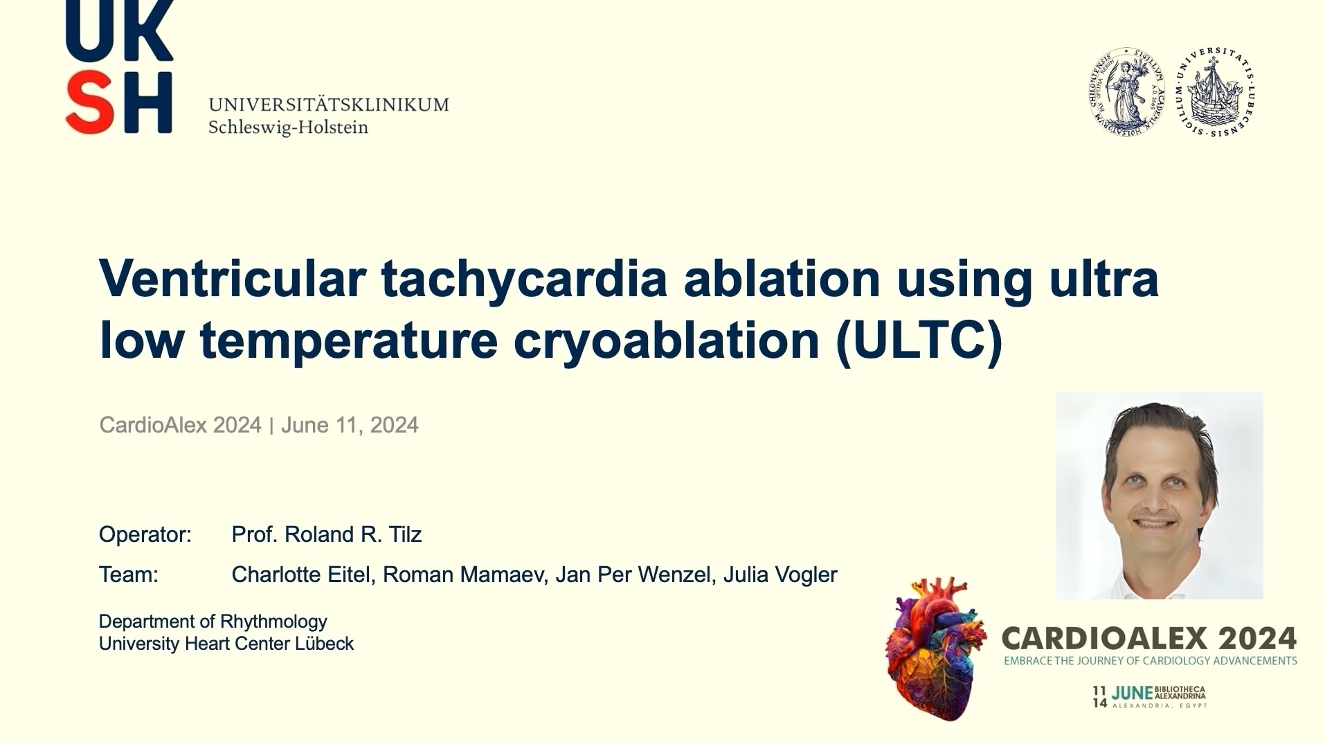 Ventricular Tachycardia Ablation Using Ultra-Low Temperature Cryoablation (ULTC)