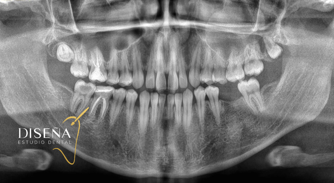 Diseña Estudio Dental