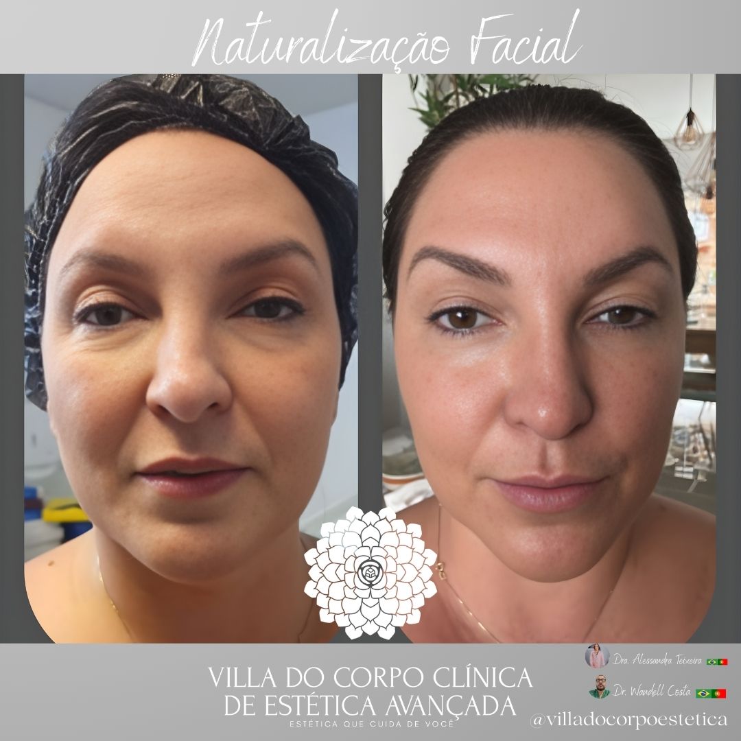 Avaliação Personalizada