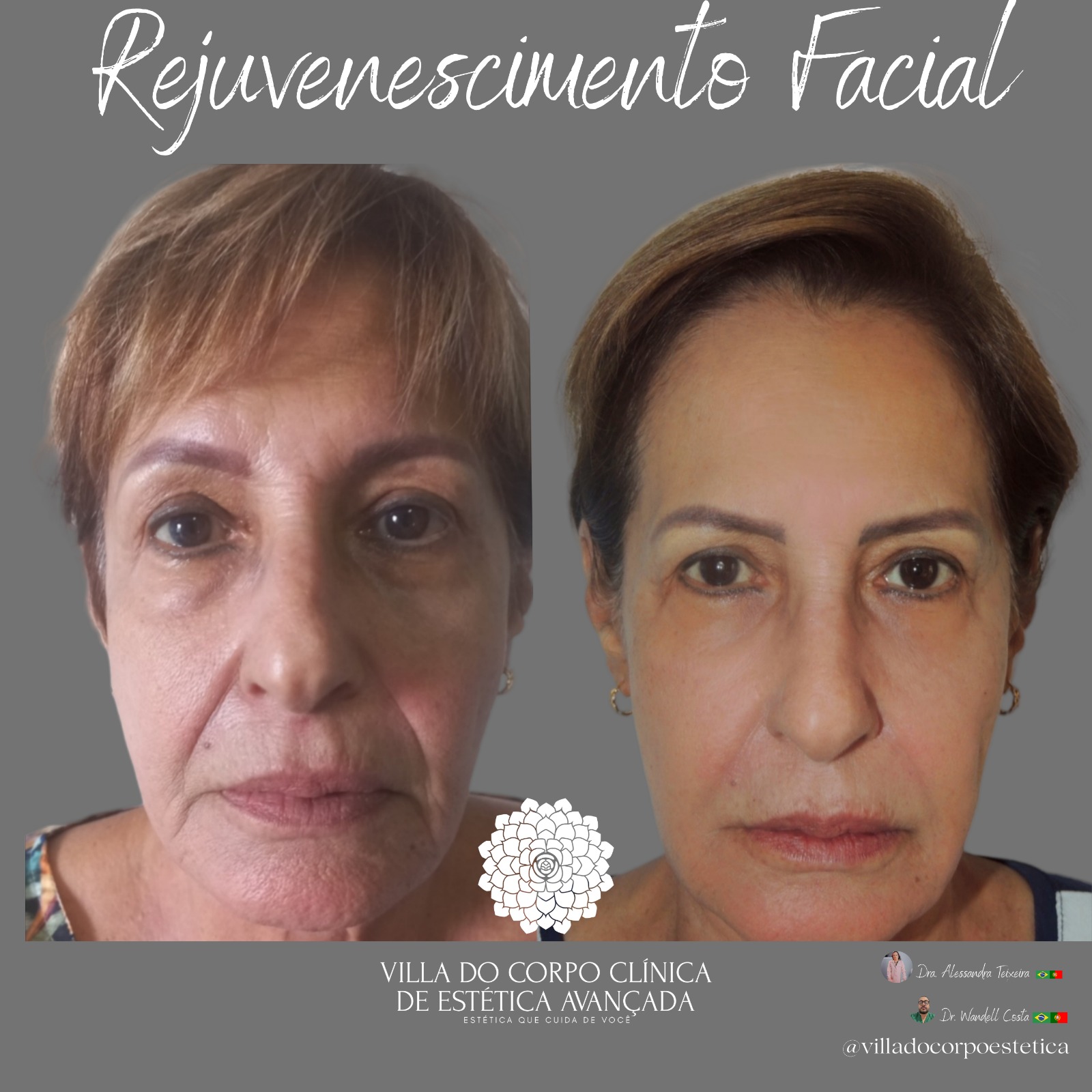Naturalização Facial