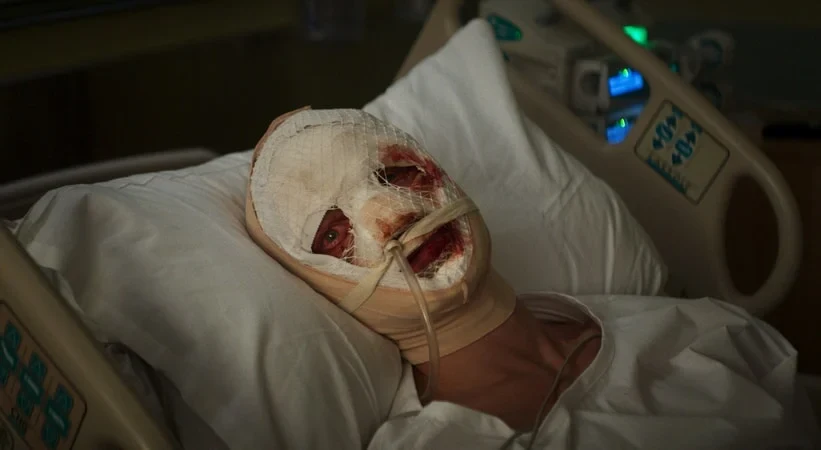 Matt Hagen vendado en un hospital en Clayface