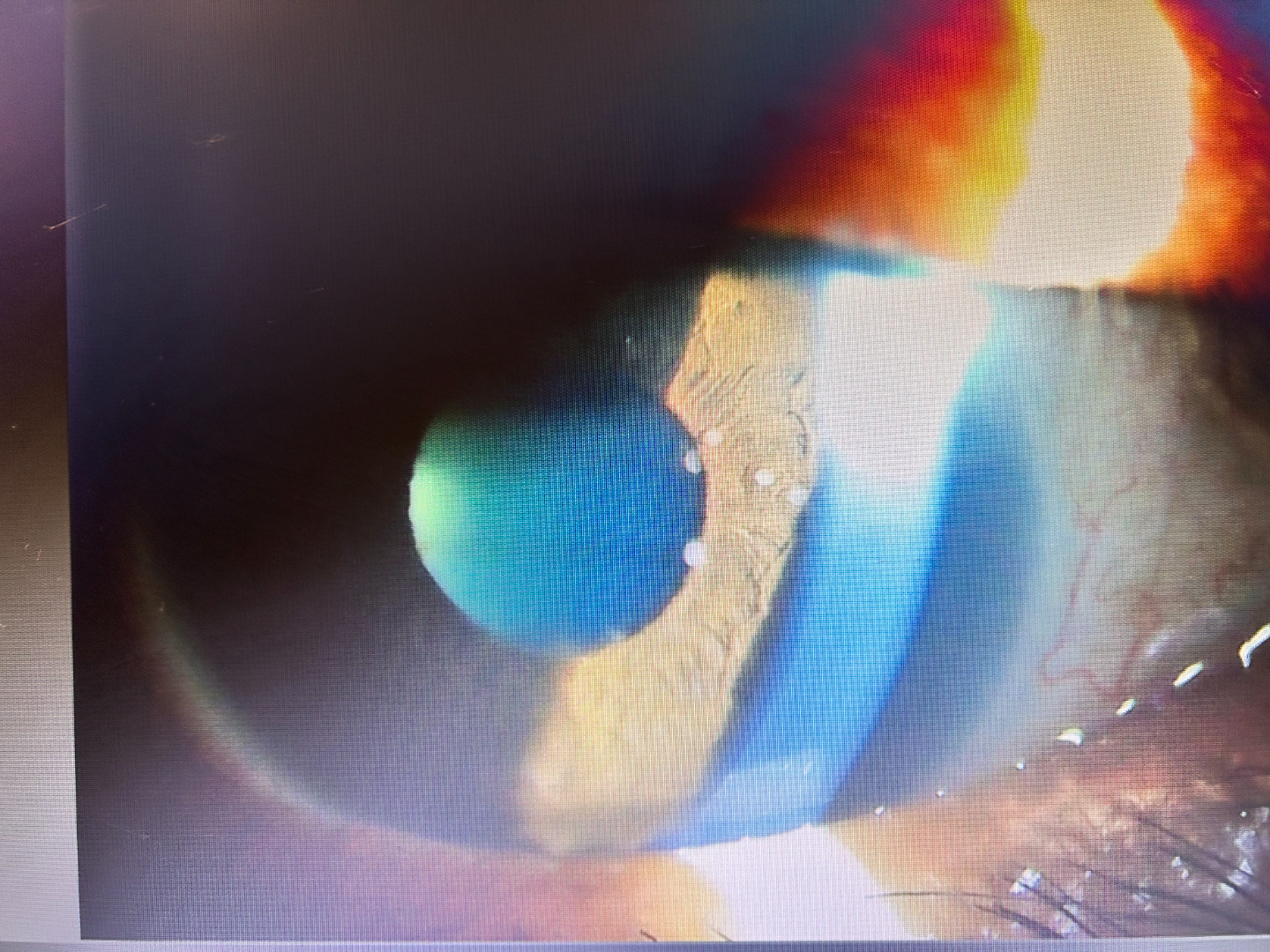 Photo of Dr Smriti Dabas, Ophthalmology in Hyderabad, State