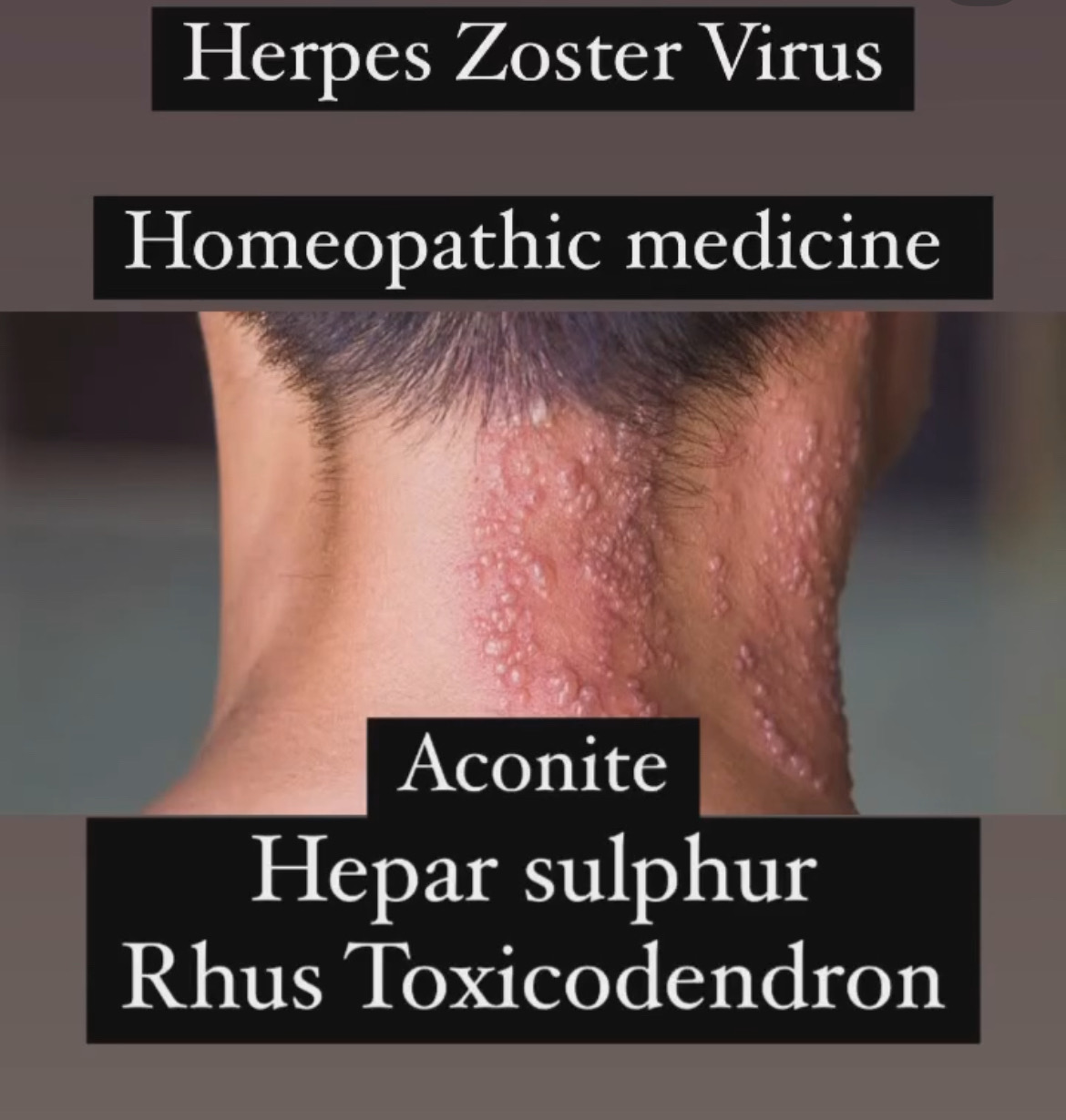Homeopathy works well in skin disease