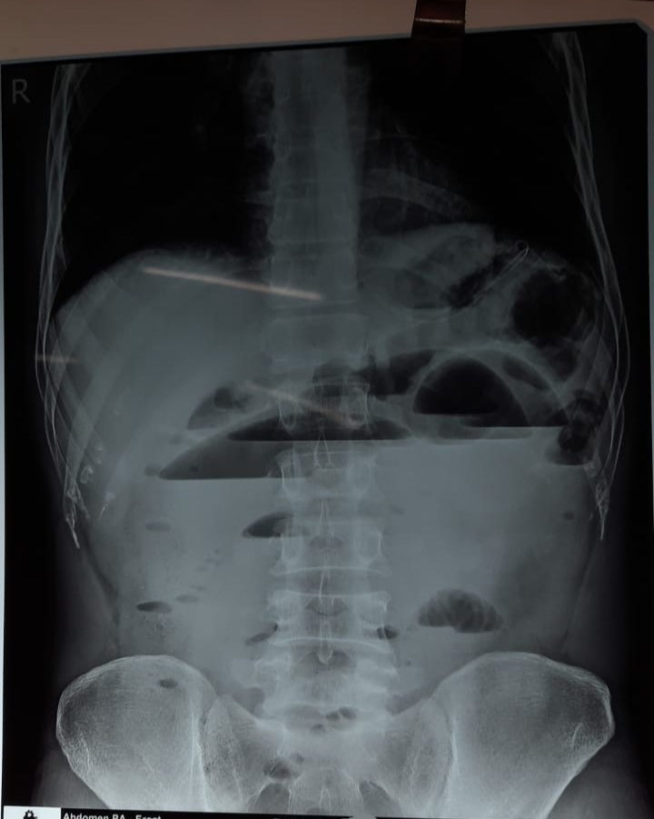 comment about the findings.  ....