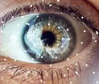 Computer vision and artificial vision: what is it?