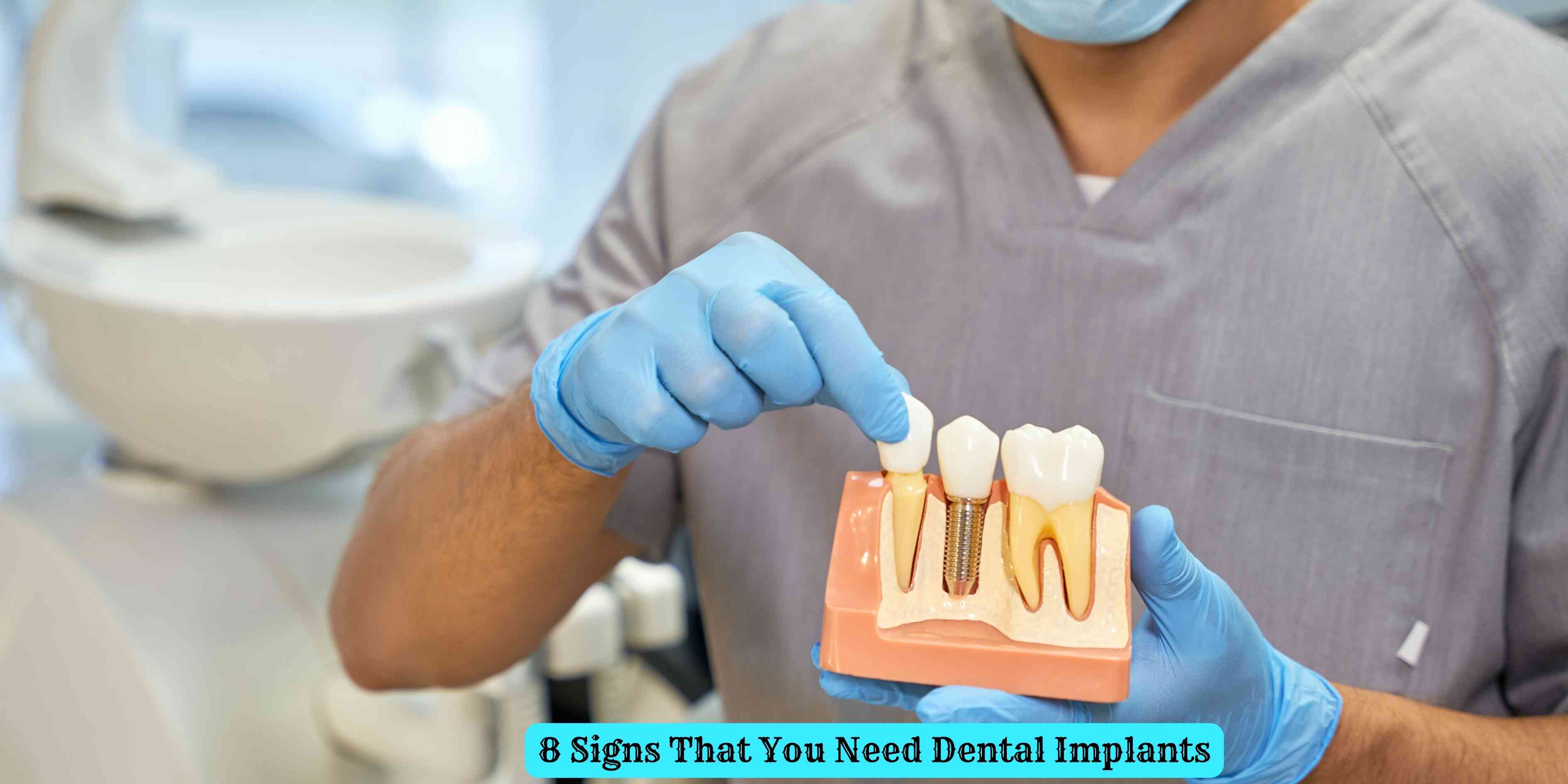 8 Signs That You Need Dental Implants