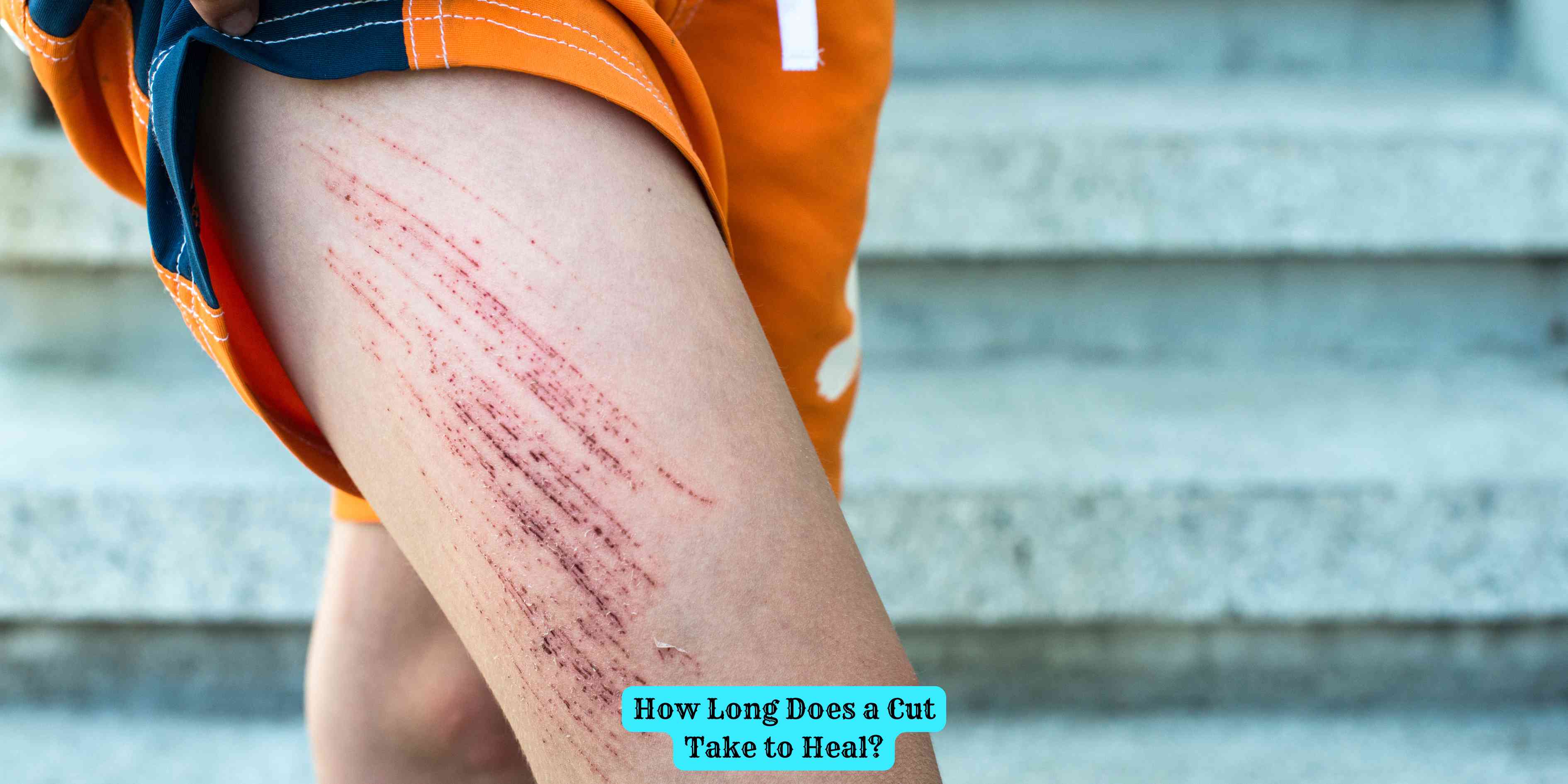 How Long Does a Cut Take to Heal?