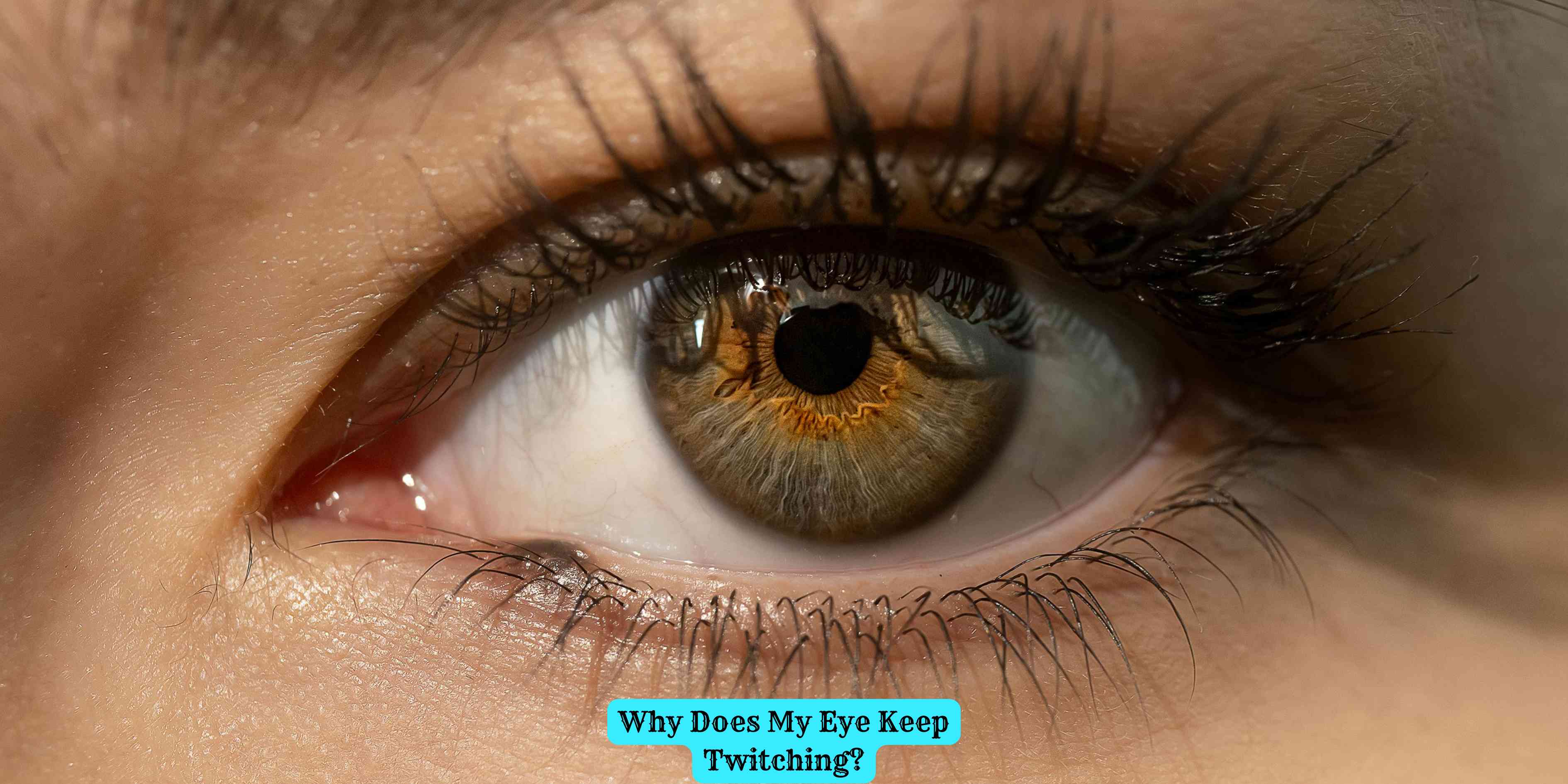 Why Does My Eye Keep Twitching?