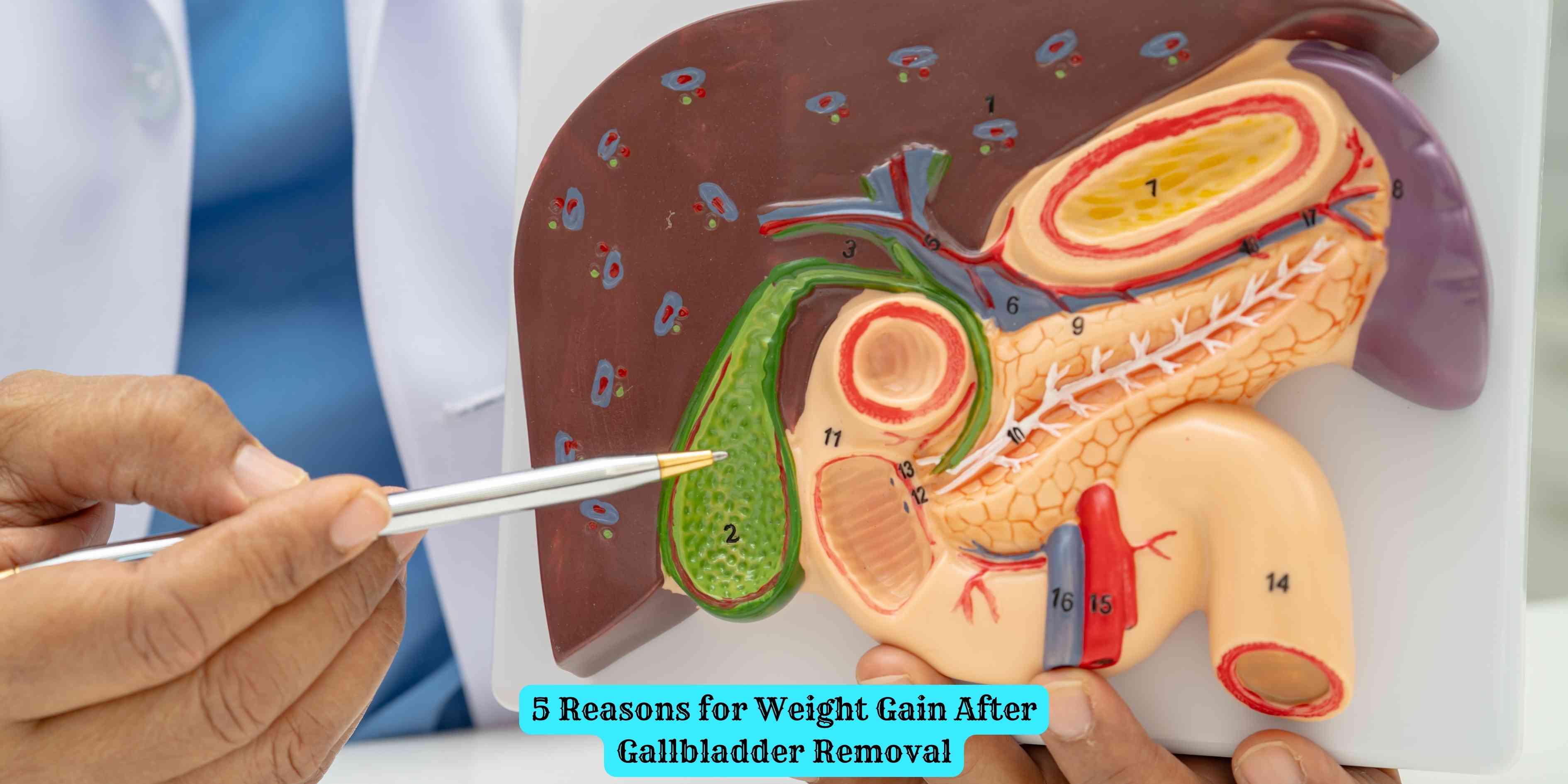 5 Reasons for Weight Gain After Gallbladder Removal