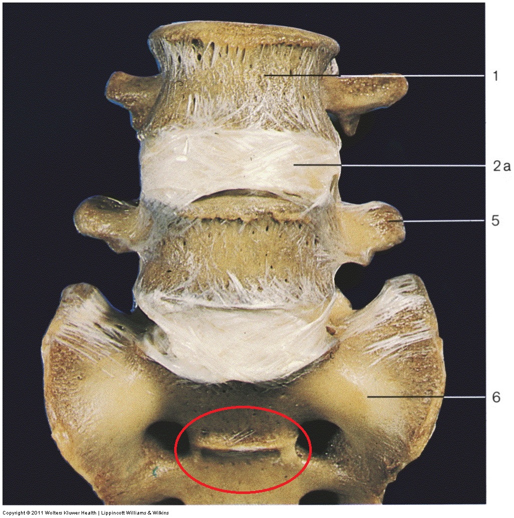 fused vertebrae