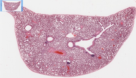 virtual slide of human lung