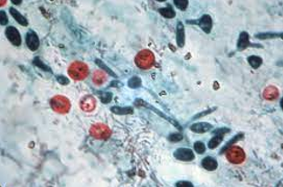 A close-up of a microscope

AI-generated content may be incorrect.