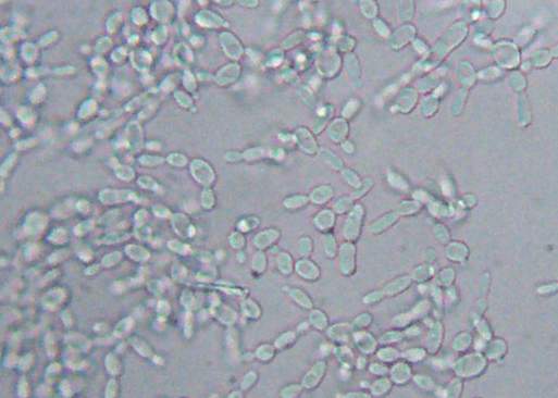 File:Candida wet mount.jpg - Wikimedia Commons