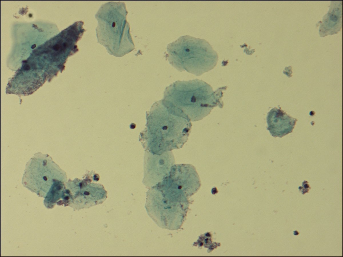 Gardnerella vaginalis - Wikipedia, la enciclopedia libre