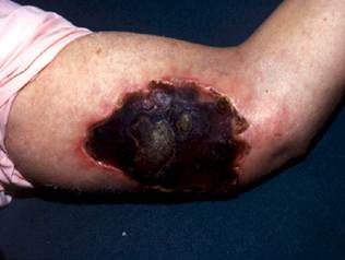 A close-up of a person's foot

Description automatically generated with low confidence