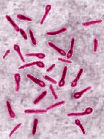 Tetanus - Clostridium tetani - Oxford Sandy and Black Pig Foundation Charity