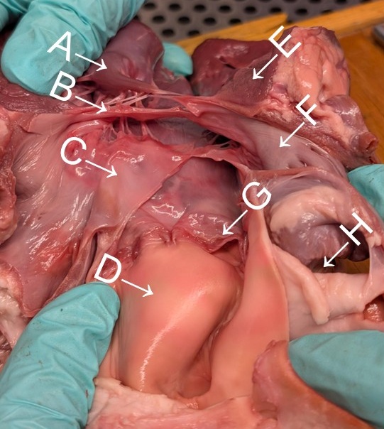fresh heart dissected left ventricle from above
