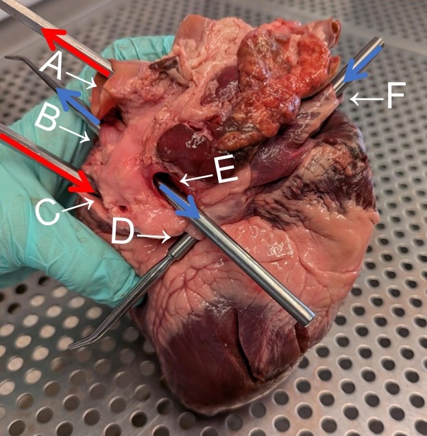 fresh heart specimen, dorsal aspect