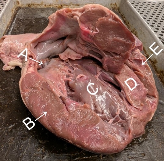 frontal longitudinal section of a fresh dissected heart