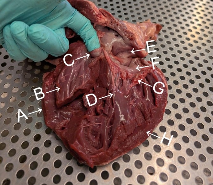fresh dissected heart specimen long front section right ventricle