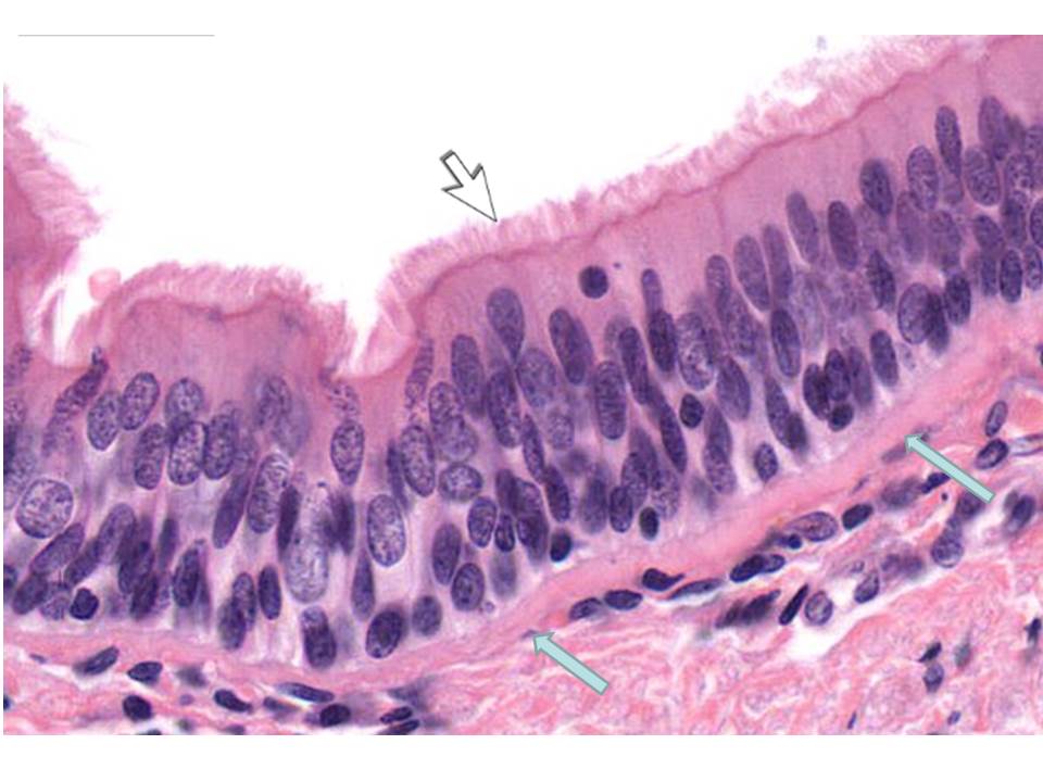 повітр трахея