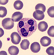 kulatá krevní buňka s jemnými granuly a 5 jadernými segmenty