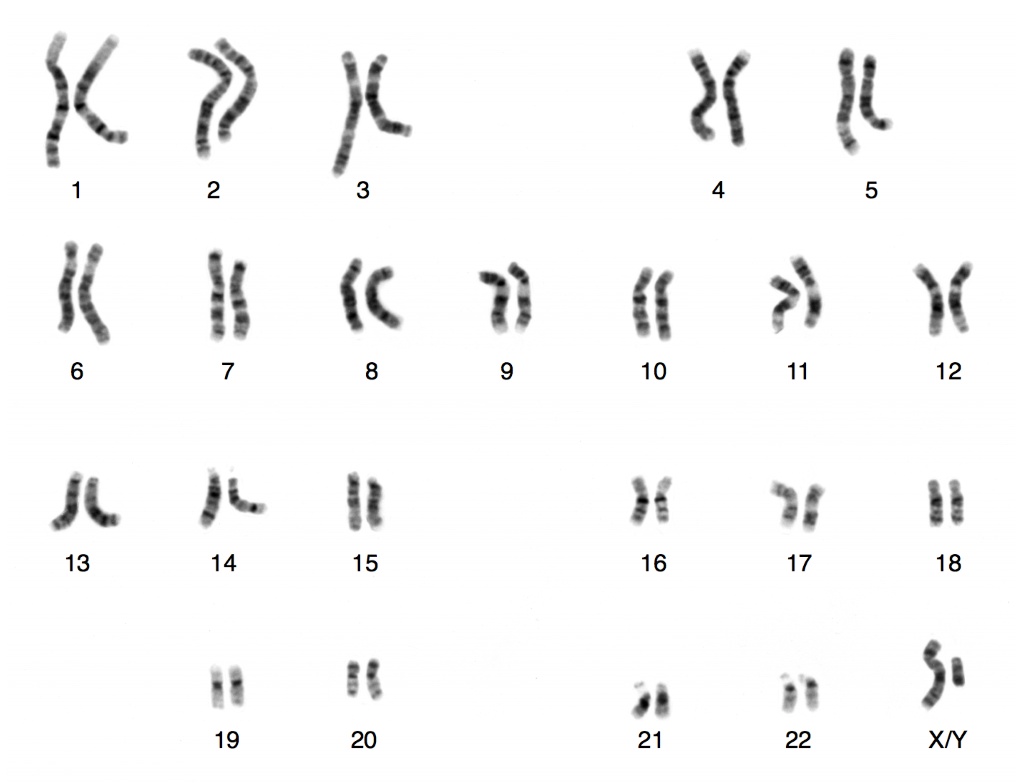 Karyotype of a human male using Giesma staining