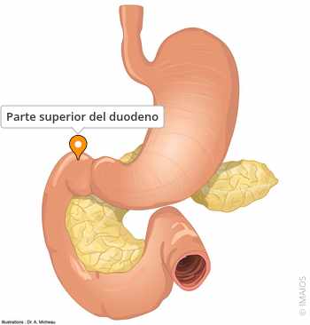 Parte superior del duodeno - e-Anatomy - IMAIOS