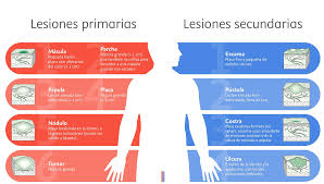 Lesiones cutáneas primarias y secundarias