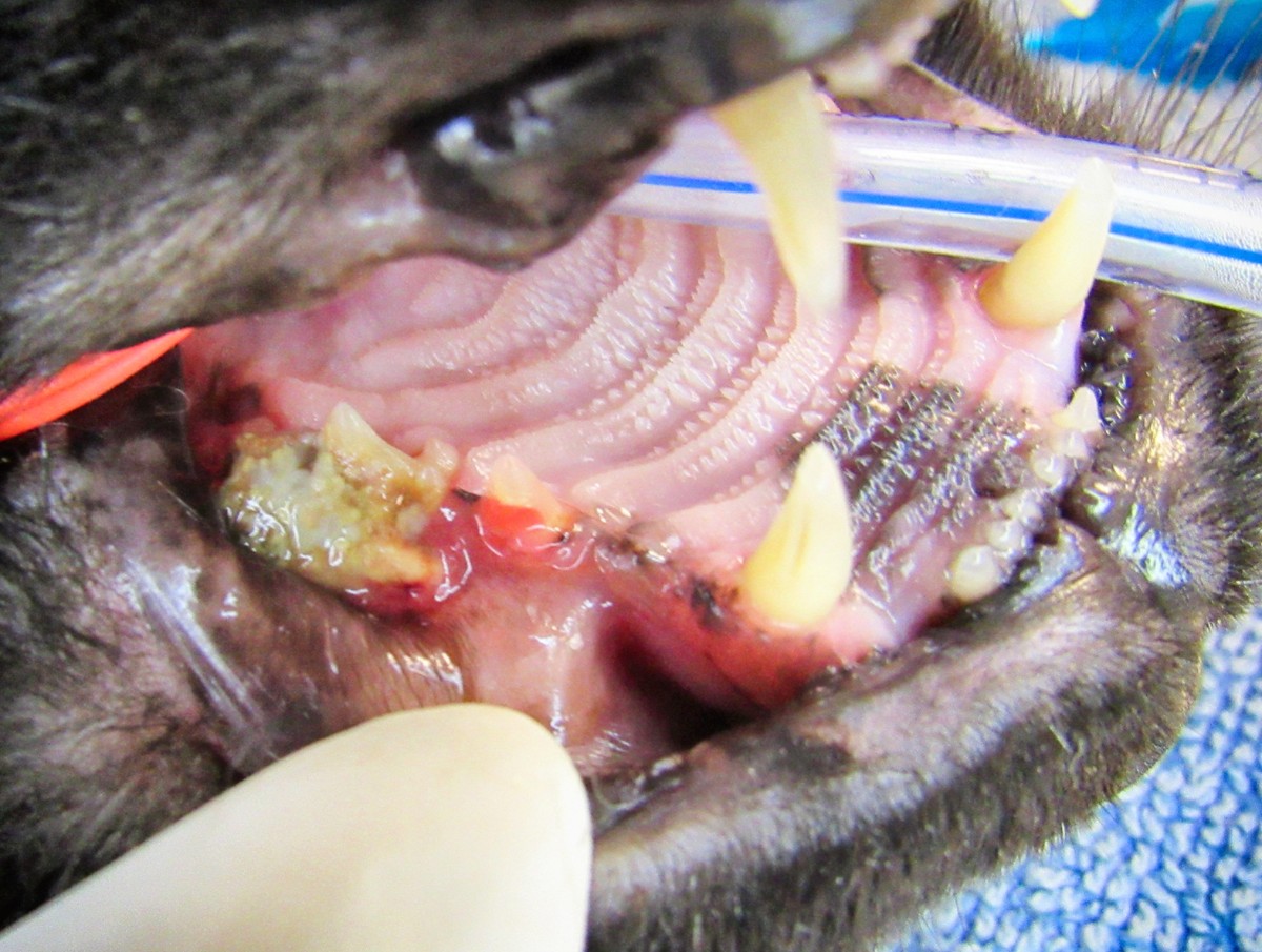 Severe periodontal disease with bone and gum recession