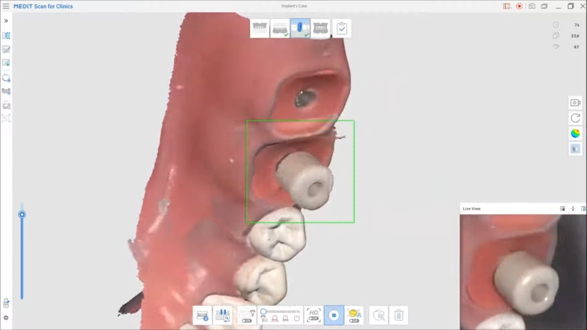 Écran