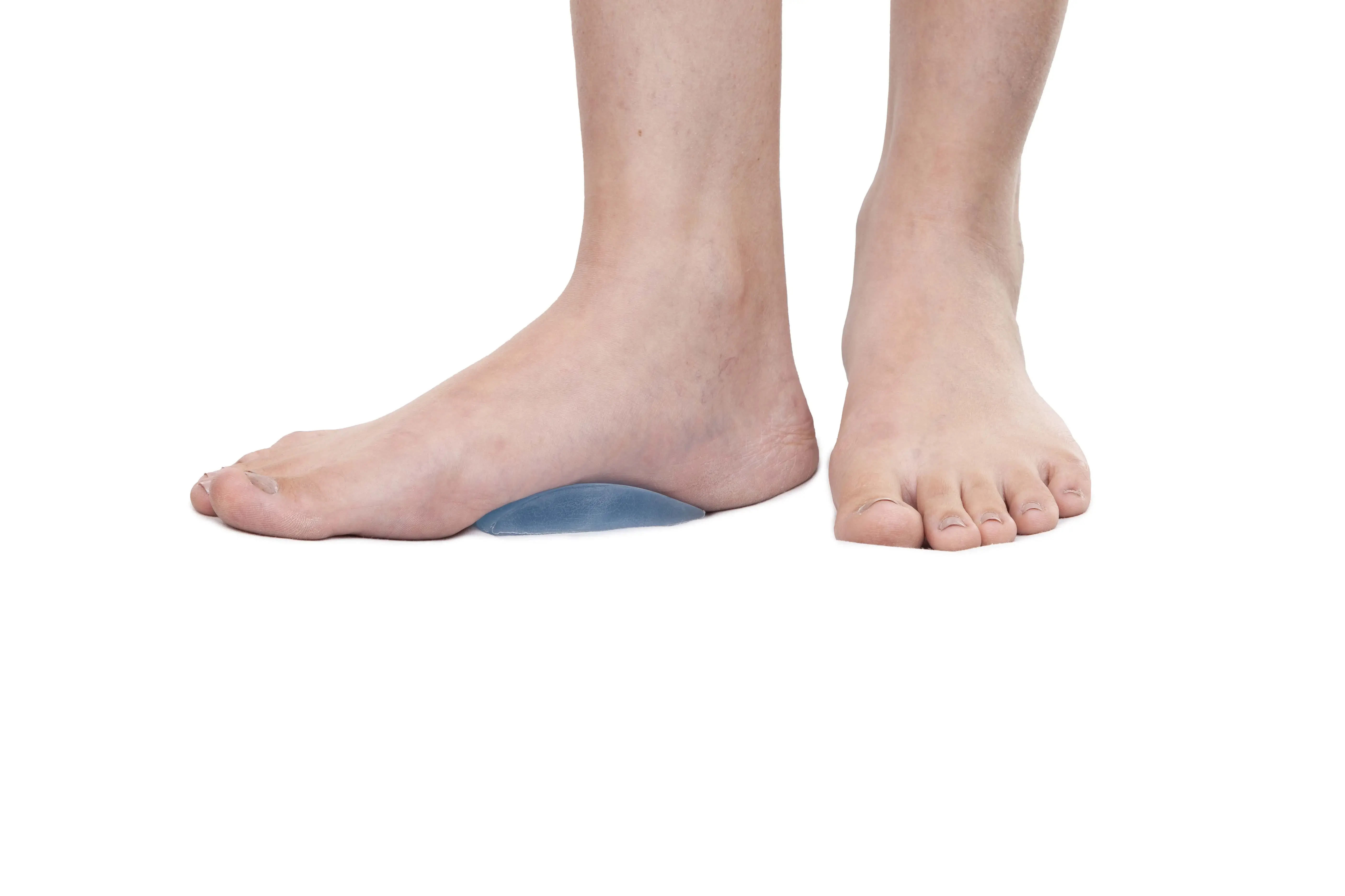 Medemove Arch Support - Orthotics by Darshan Elders Care - High quality medical equipment