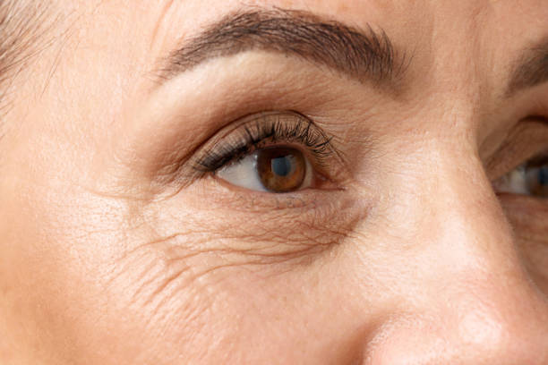 Under Eye Treatments