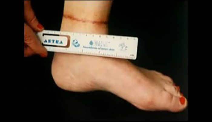 Otros 2 casos de abducción | 9