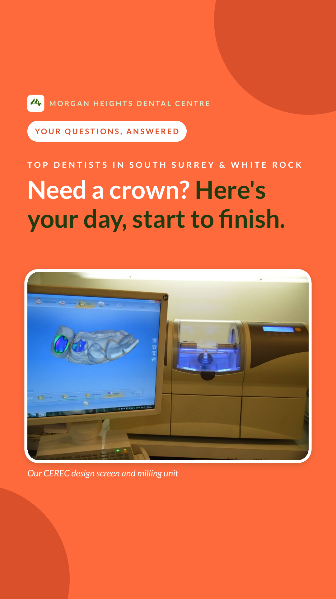 How Same-Day CEREC Crowns Work: A South Surrey Patient's FAQ