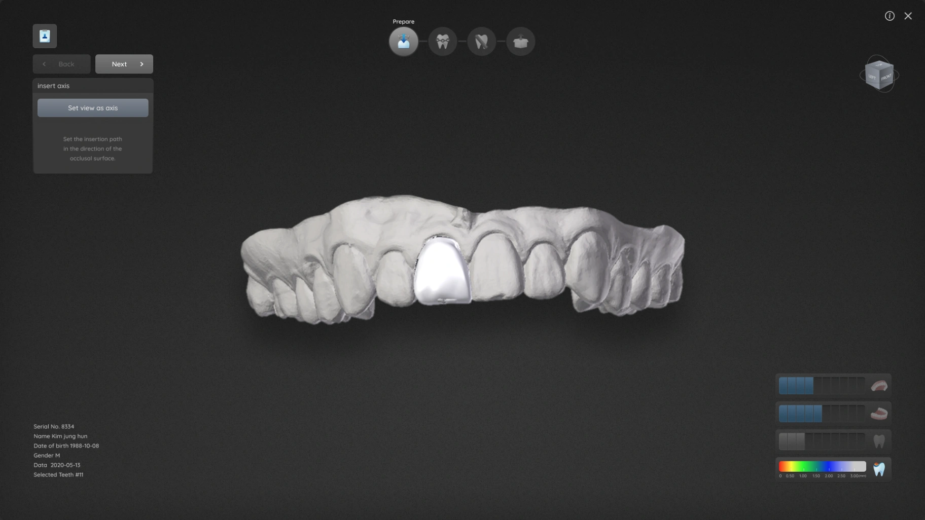 덴탈소프트웨어 GUI 개발 gallery image 1